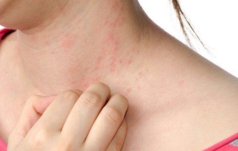 Các hình ảnh loại bệnh