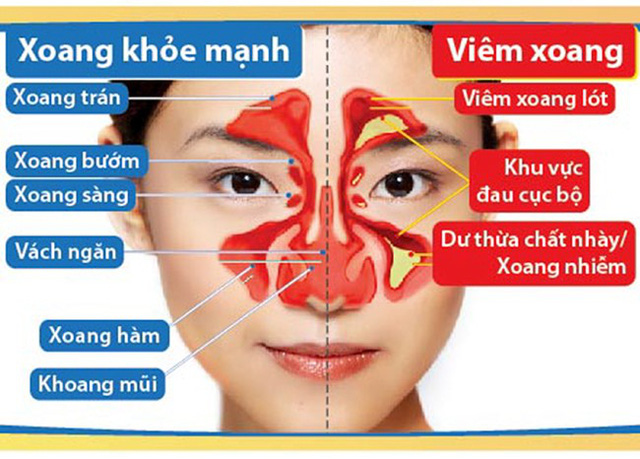 Các hình ảnh loại bệnh